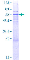 12.5% SDS-PAGE Stained with Coomassie Blue.